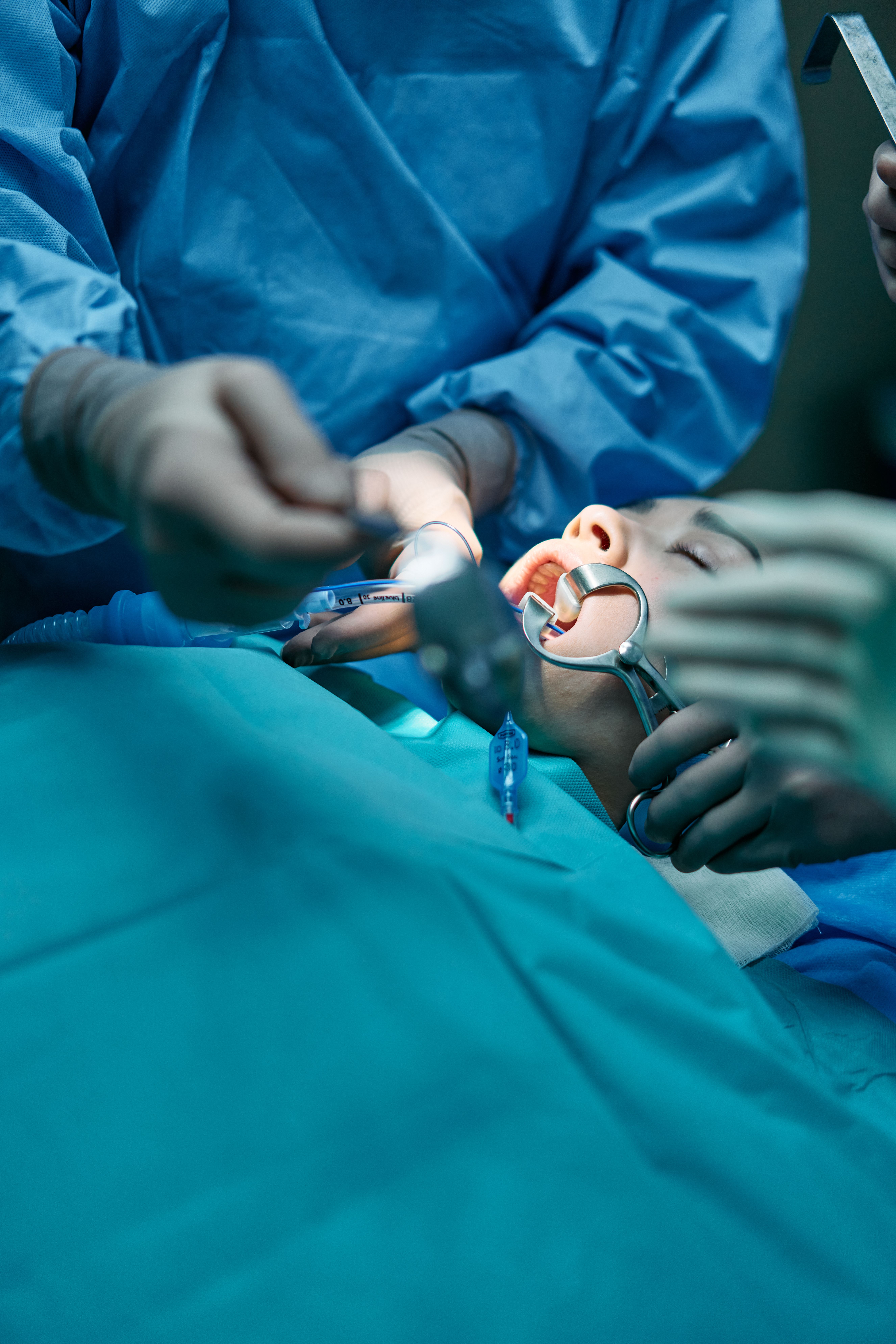 Restorative dental procedure in progress